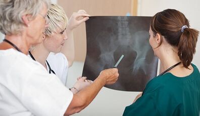 Diagnóstico de venas varicosas de una pelvis pequeña